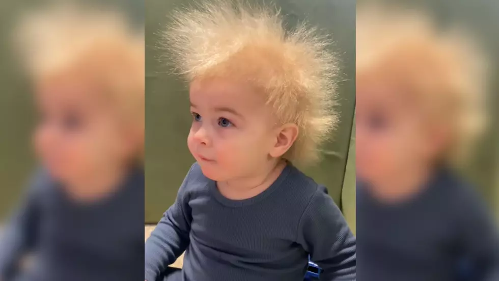 Little Boy With Wild ‘Uncombable Hair Syndrome’ Becomes Internet Sensation (PHOTOS)
